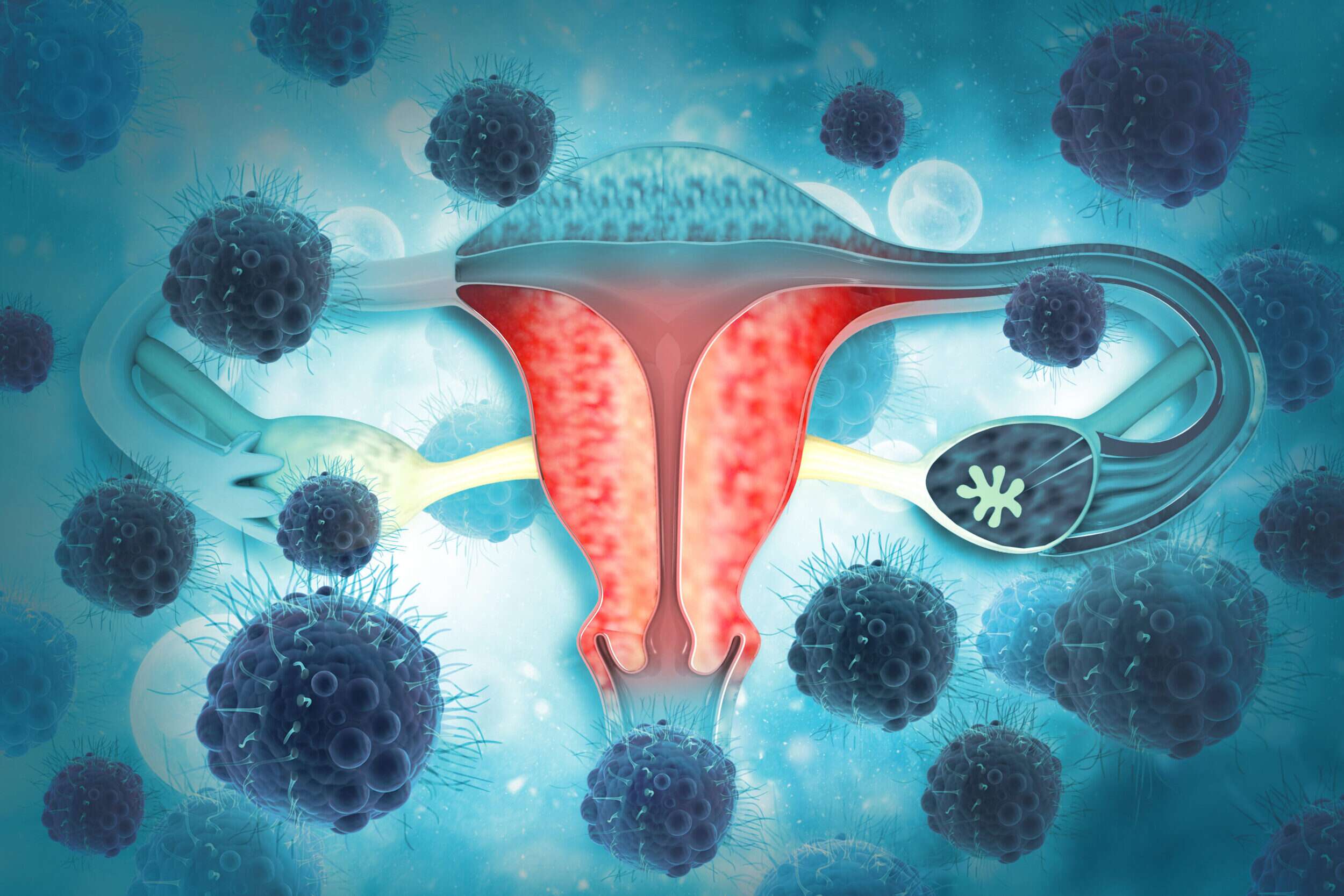 ¿Se puede detectar el cáncer de ovario en sus comienzos?