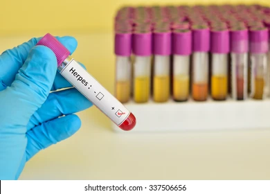 La OMS alerta sobre el aumento de enfermedades de transmisión sexual